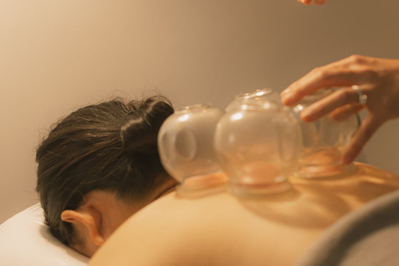 Cupping Therapy